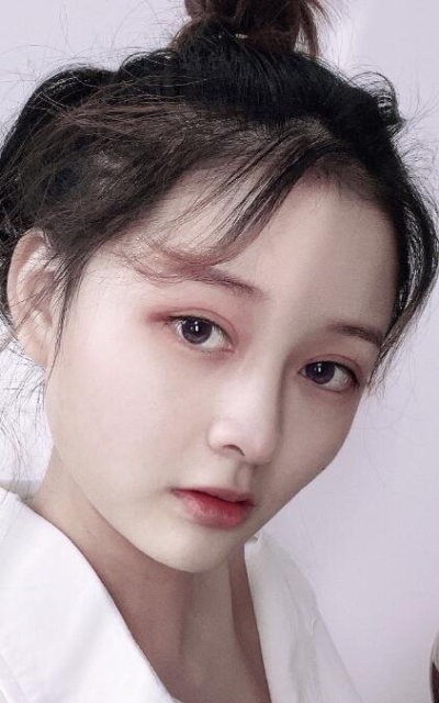 上海藝星醫(yī)療美容醫(yī)院金洙哲隆鼻案例效果分享