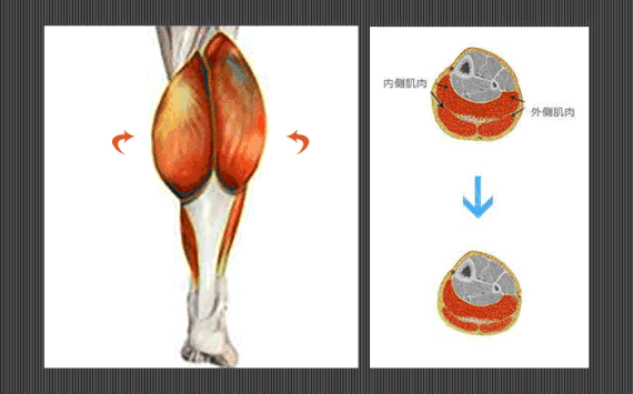 小腿肌肉阻斷術(shù)是什么？小腿神經(jīng)阻斷術(shù)的后遺癥有嗎？