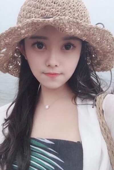 上海新健威醫(yī)療美容門診部做雙眼皮手術后三天的情況