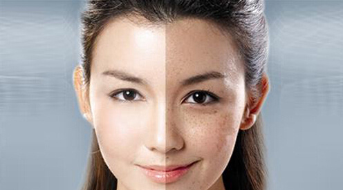 鐳射凈膚的原理功效 ？鐳射凈膚和m22是一種東西嗎？