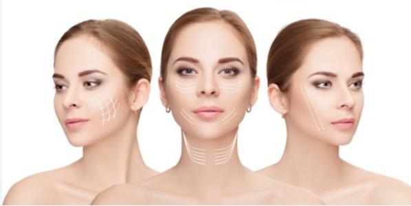 嗨體去頸紋幾天有效果 嗨體去頸紋如何延長維持時間