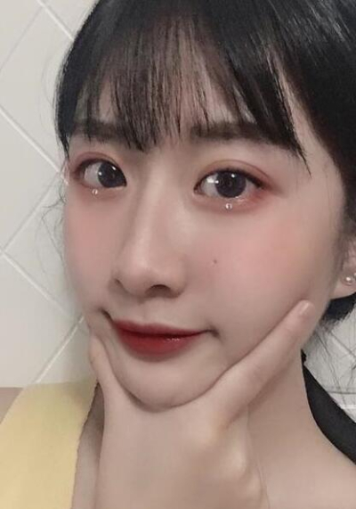 珠海陸達美容外科醫(yī)院陳越文下頜骨案例效果分享