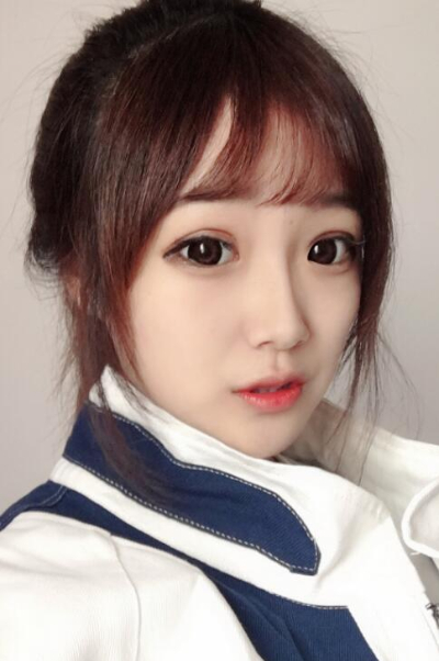 蘇州愛(ài)思特醫(yī)療美容醫(yī)院做隆鼻手術(shù)后的鼻子狀態(tài) 蘇州愛(ài)思特醫(yī)療美容醫(yī)院做隆鼻手術(shù)后的鼻子狀態(tài)