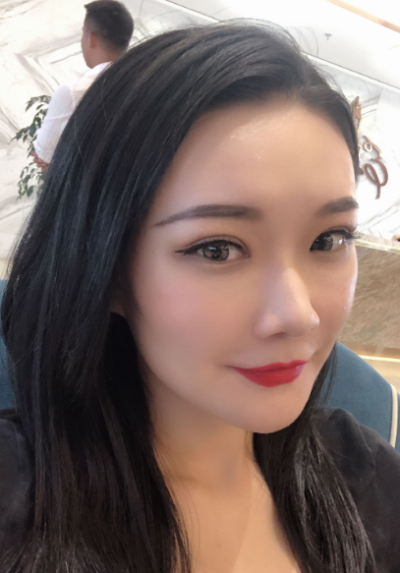 寧波尚美整形美容醫(yī)院齊強雙眼皮案例效果分享