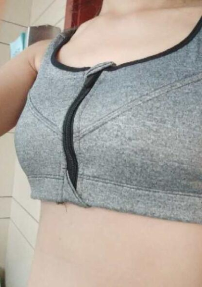 上海美萊醫(yī)療美容門診部做隆胸手術(shù)后一個月的情況 上海美萊醫(yī)療美容門診部做隆胸手術(shù)后一個月的情況