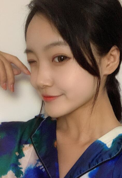 蘇州愛(ài)思特醫(yī)療美容醫(yī)院做隆鼻手術(shù)后的鼻子的日常 蘇州愛(ài)思特醫(yī)療美容醫(yī)院做隆鼻手術(shù)后的鼻子的日常