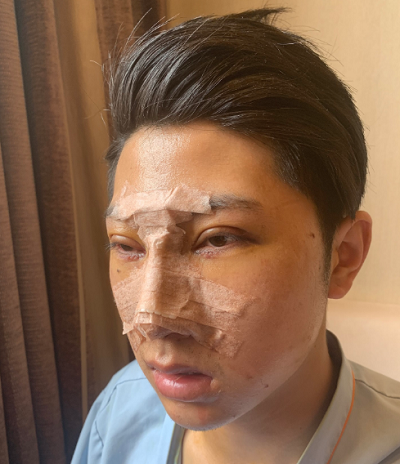 長(zhǎng)春中妍醫(yī)療美容醫(yī)院做鼻綜合手術(shù)后 長(zhǎng)春中妍醫(yī)療美容醫(yī)院做鼻綜合手術(shù)后