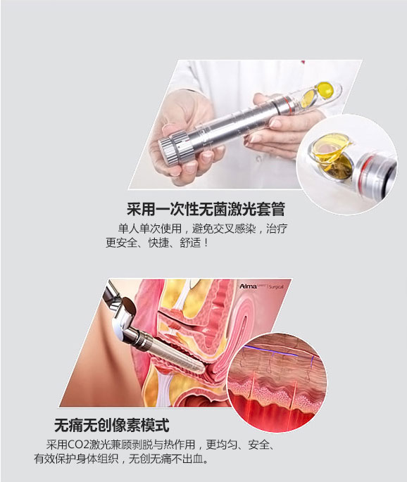 成都愛(ài)爾麗整形激光緊縮陰道怎么樣？激光緊縮陰道注意什么？