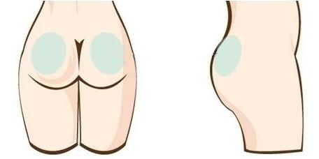 成都大華韓藝做臀部吸脂減肥安全性如何有什么特點(diǎn)？