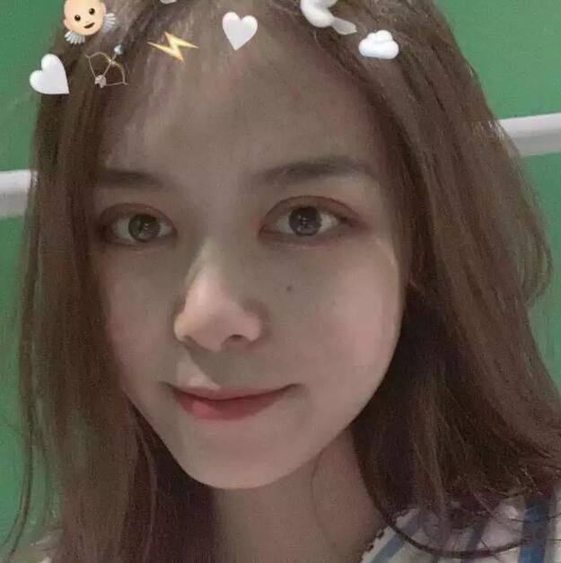 鄭州壹加壹王洛生全切雙眼皮案例術(shù)后一個(gè)月 鄭州壹加壹王洛生全切雙眼皮案例術(shù)后一個(gè)月