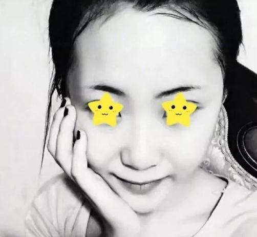 上海首爾麗格安建榮鼻綜合真人案例術(shù)前