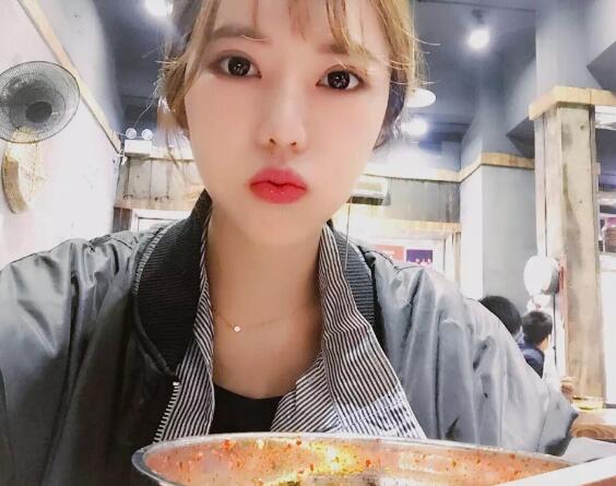 第四軍醫(yī)大學(xué)唐都醫(yī)院李望舟雙眼皮案例術(shù)后兩個月