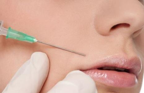 注射填充法令紋的方式有哪些？如何通過(guò)醫(yī)美手段祛法令紋？