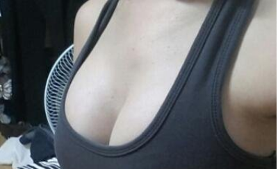 成都美立方(原華博)醫(yī)療美容醫(yī)院做假體隆胸術(shù)后的最終效果 成都美立方(原華博)醫(yī)療美容醫(yī)院做假體隆胸術(shù)后的最終效果