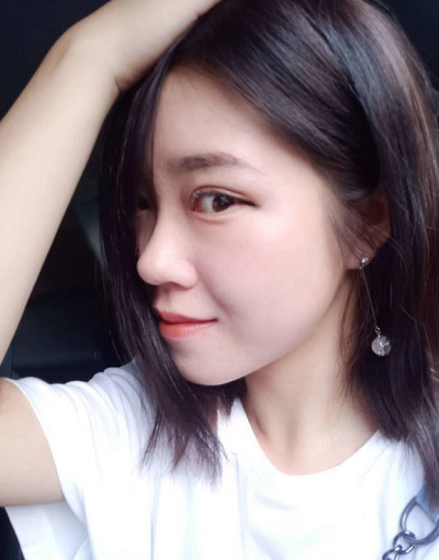 北京東方瑞麗醫(yī)療美容門診部做雙眼皮手術(shù)后的日?；謴?fù)情況