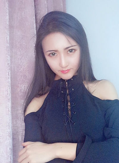 上海時光整形外科醫(yī)院王濤做顴骨整形案例效果分享