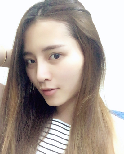 深圳微姿醫(yī)療美容門診部做鼻綜合手術(shù)后的日常恢復(fù)