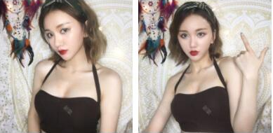 武漢米蘭醫(yī)療美容門診部做假體隆胸手術(shù)后的最終效果