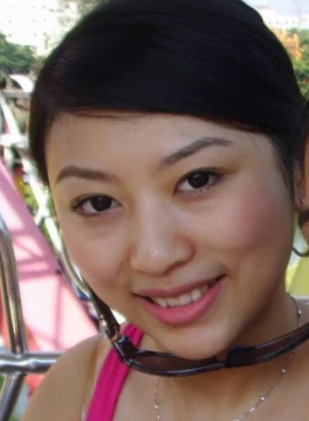 南京美貝爾醫(yī)療美容醫(yī)院做假體隆鼻手術(shù)前的樣子